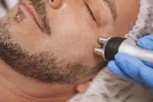 Anti-age tretman za masnu kožu